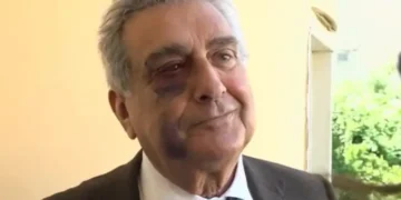 Penalista pestato e rapinato, un software per incastrare i banditi